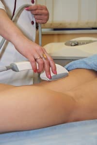 IPL Laser Vein at Creative Image Laser Solutions in Brownwood TX