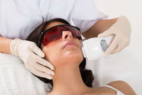 gettting CO2 laser skin resurfaceing in Brownwood TX