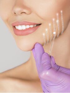 Thread Lift in Brownwood, TX | Non-Surgical Facelift | PDO thread lift | Silhouette InstaLift