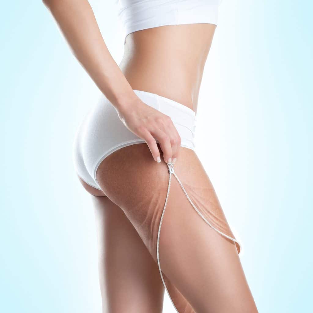 Cellulite Therapy in Brownwood TX