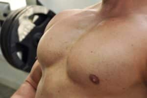 Male Breast Reduction Brownwood, TX