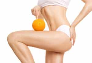 Cellulite Therapy in Abilene TX