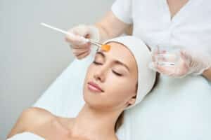 Chemical peels