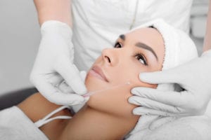 Thread Lift in Brownwood, TX | Non-Surgical Facelift | PDO thread lift | Silhouette InstaLift