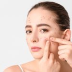 woman with acne problem squishing pimples